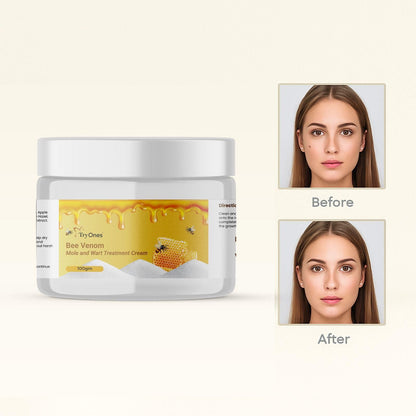 Mole and Wart Treatment Cream